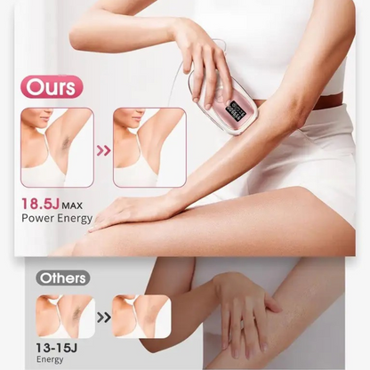 IceLuxe Hair Removal